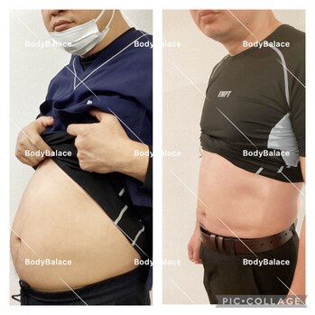 Before After
